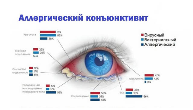 Почему лопаются сосуды в глазах? Причины и лечение