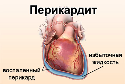 Болезни сердца: список и симптомы, лечение