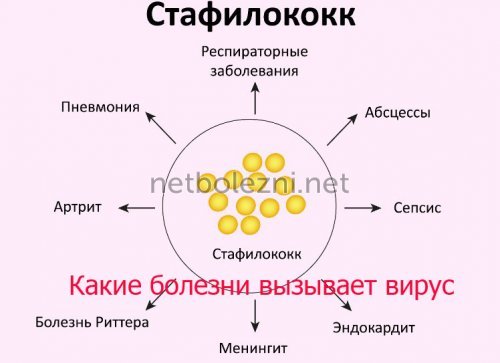 Золотистый стафилококк у детей и взрослых, симптомы и лечение