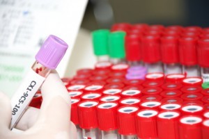 Как понизить гемоглобин в домашних условиях народными средствами
