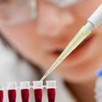 Тромб в сонной артерии: лечение, симптомы и удаление