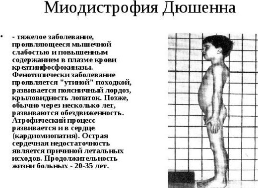 Общая креатинкиназа (СК-МВ, КФК) в крови: норма, повышенна, пониженна