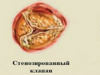 133. Слои стенки сердца, их функции.