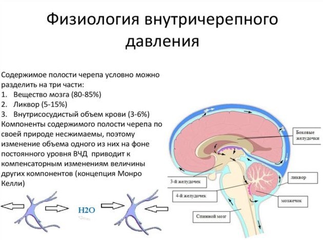 Что такое внутричерепная гипертензия и как её лечить