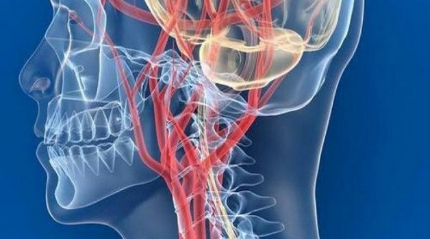 Тахикардия при остеохондрозе, от чего может быть