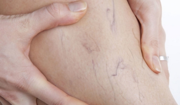 Анавенол - инструкция по применению, отзывы