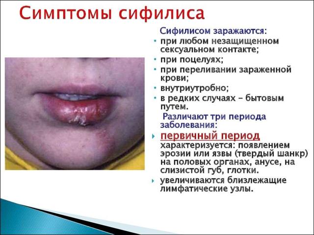 Сифилис у женщин – первые признаки, симптомы, лечение