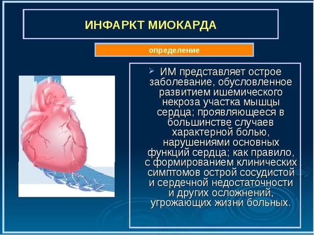 Инфаркт миокарда на ЭКГ: признаки, расшифровка
