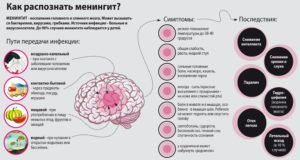 Менингит: симптомы и лечение у детей и взрослых