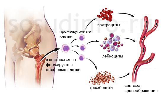 Что такое Полицитемия истинная?