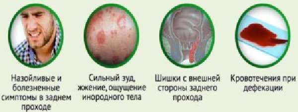 Чешется ли геморрой - Геморрой