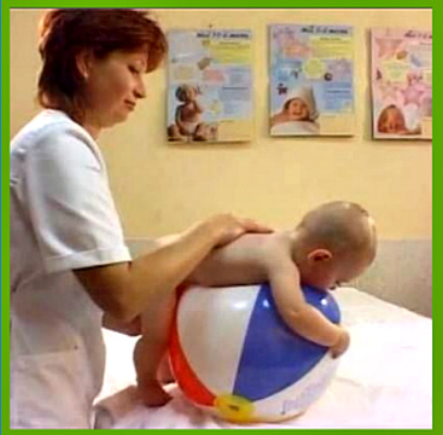 Мышечная гипотония у новорожденных и детей