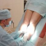 Осложнения и последствия после склеротерапии