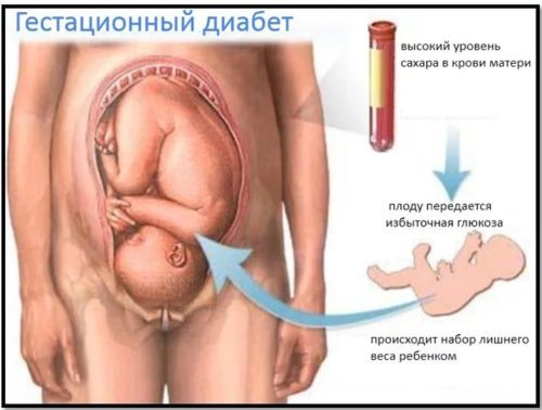 Гемоглобин А1С норма (таблица). Гемоглобин А1С повышен или понижен - что это значит