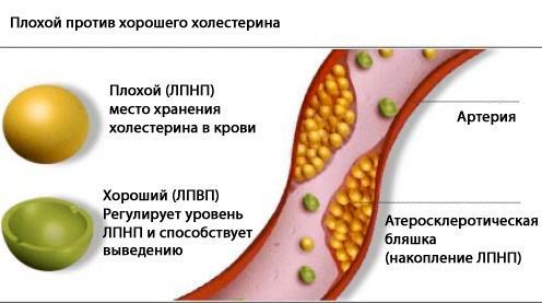 Холестерин 7 2 это много - Про холестерин