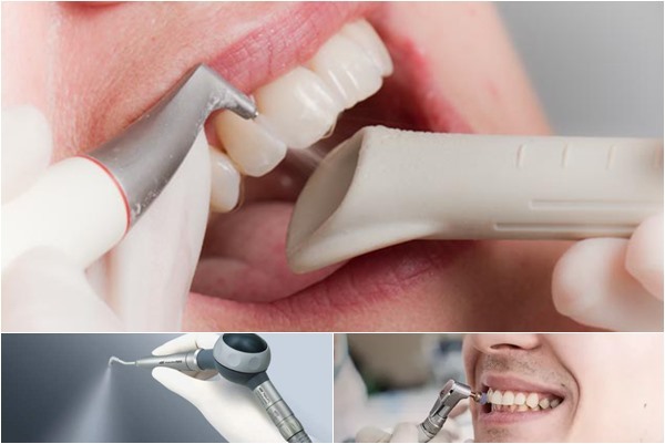 Острый, язвенно-некротический гингивит Венсана: лечение, симптомы и диагностика