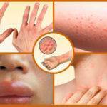 Холагол - инструкция по применению, цена и аналоги