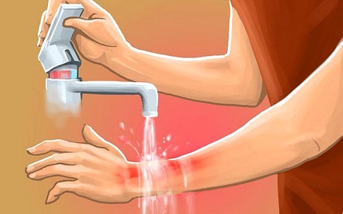 Лечение гипертонии йодом (по индийскому методу)