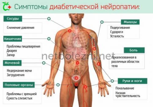 Мазь при полинейропатии нижних конечностей: классификация, медикаменты, народные средства, проявления