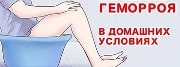Лечение геморроя народными средствами в домашних условиях. Рецепты народной медицины