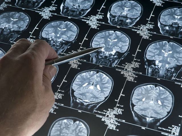 АНГИОФЛЮКС - инструкция по применению, цена, отзывы и аналоги