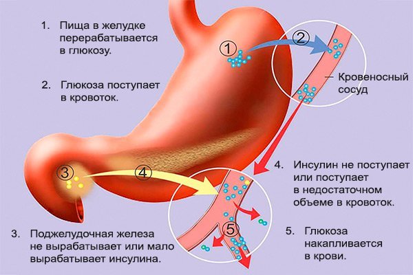 Норма СОЭ в крови у мужчин, женщин и детей по возрасту. Таблица. СОЭ выше нормы