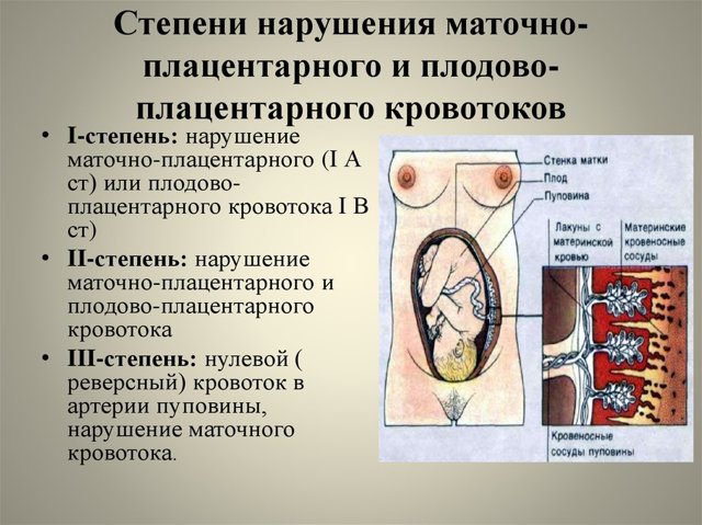 Гемодинамические нарушения 1 а степени при беременности