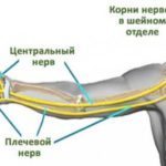 Боль в ключице, болит правая или левая ключица
