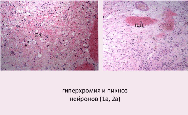 Анизохромия что это такое