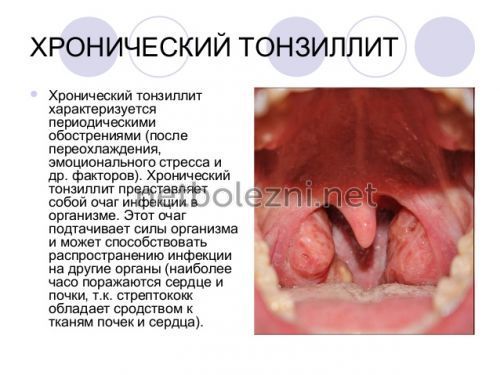 Черный налет на языке — начало больших проблем