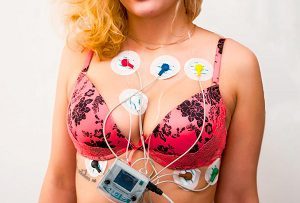 Регулярный и нерегулярный синусовый ритм сердца