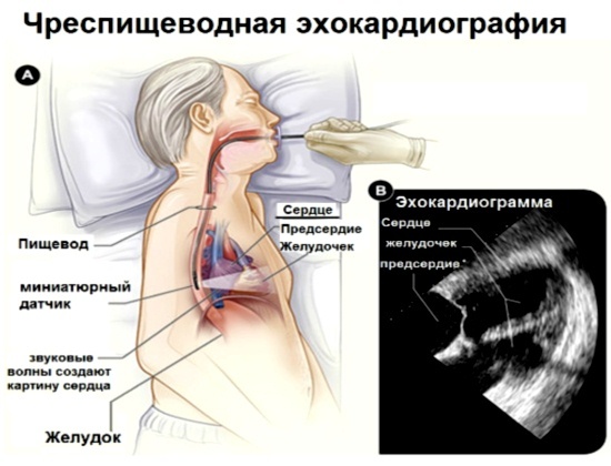 Как делают узи сердца женщинам