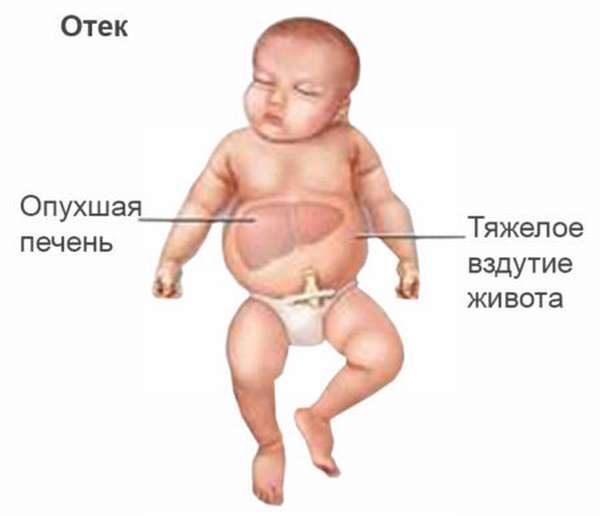Беременность и группа крови