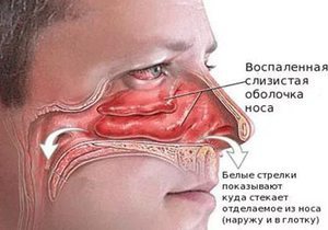 Гиперемирована слизистая желудка: что это значит, причины, лечение. Зев гиперемирован что значит