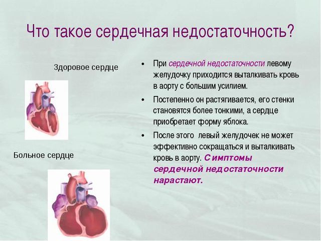 Лекарства от сердечной недостаточности список