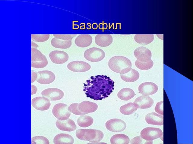 Что делать, если у ребенка повышенные базофилы