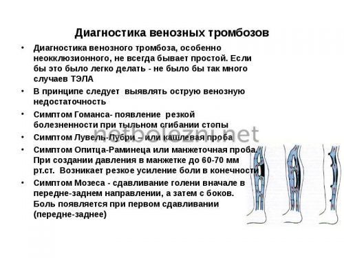 Тромб в ноге – причины, симптомы и лечение