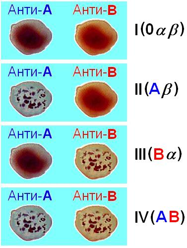 Как обозначается группа крови при сдаче анализов?