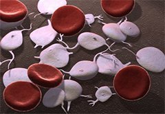 Анализ крови на билирубин - что это такое, как обозначается