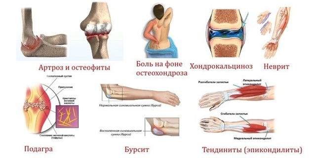 Боль в локтевом суставе: причины, лечение и профилактика