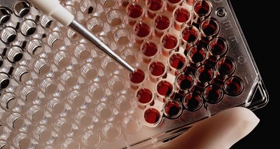 Лейкоциты у детей: норма, повышены, понижены