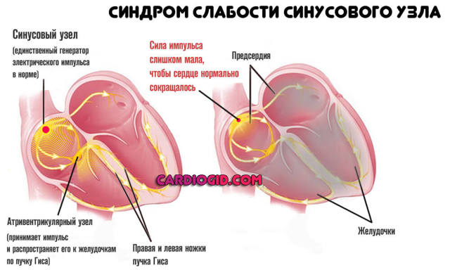 Пульс 73 удара в минуту это нормально - Все про гипертонию