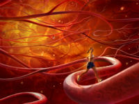 Болезни сосудов ног, лечение сосудов нижних конечностей