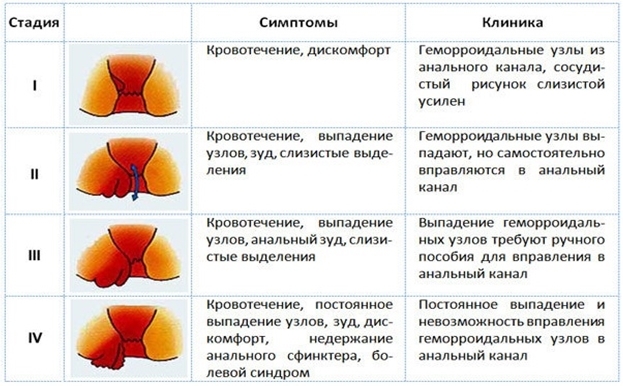 Почему при беременности появляется геморрой? Как лечить геморрой беременным женщинам?