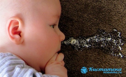 Киста сосудистого сплетения головного мозга: возникновение, диагностика, лечение. Опасна ли киста сосудистого сплетения для новорожденного?