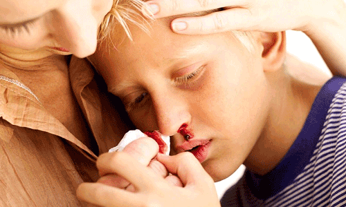 Почему идёт кровь из носа у взрослого человека. Причины и лечение народными средствами