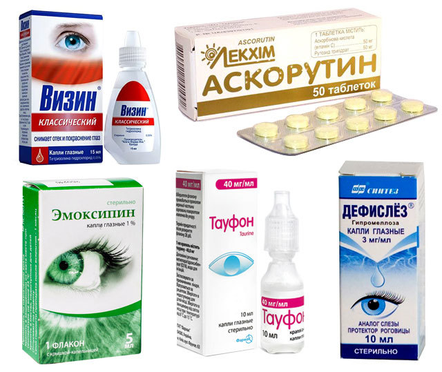 От чего лопаются сосуды в глазах: причины и лечение
