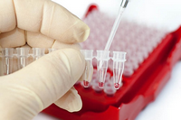 Повышенный гемоглобин в анализе крови - что означает, признаки, лечение и последствия