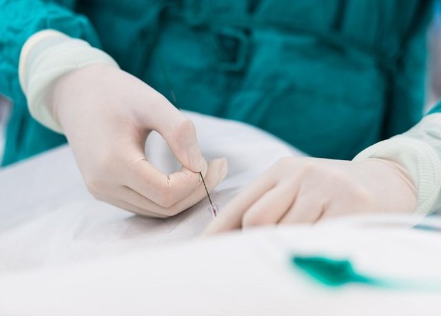 Застой в малом тазу у мужчин симптомы. Венозный застой крови в малом тазу и его последствия