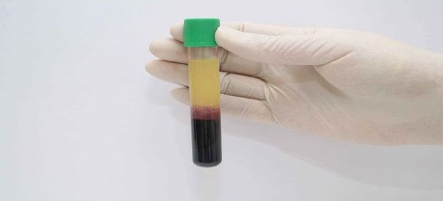 Плазма и форменные элементы крови: эритроциты, лейкоциты, тромбоциты